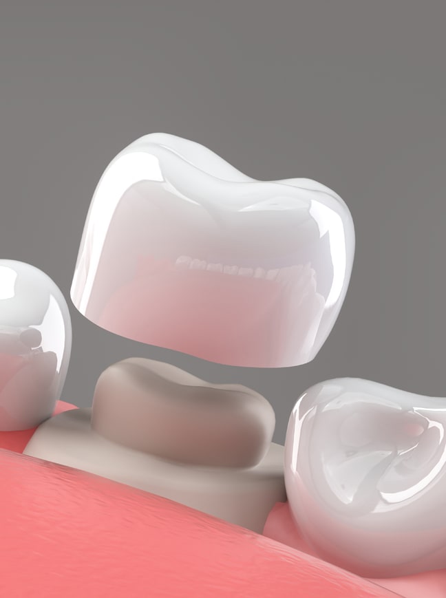 Treatment - Shine Dental